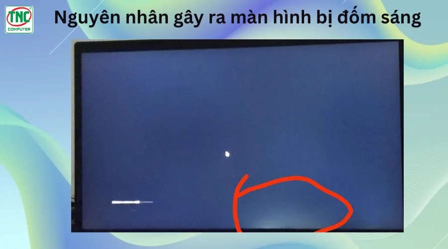 màn hình bị đốm sáng